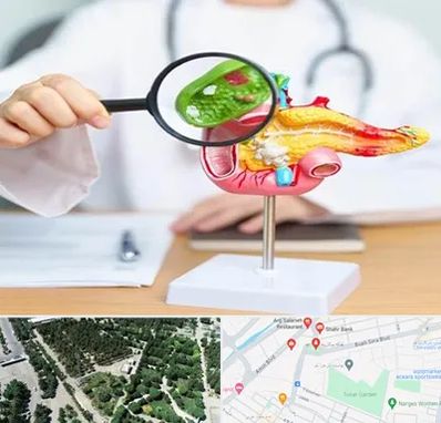 جراح سرطان پانکراس در سالاریه قم