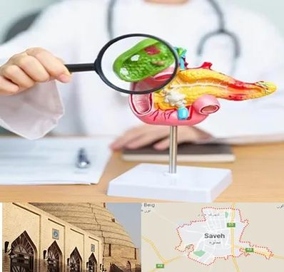 جراح سرطان پانکراس در ساوه