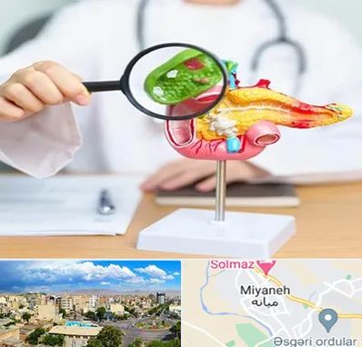 جراح سرطان پانکراس در میانه