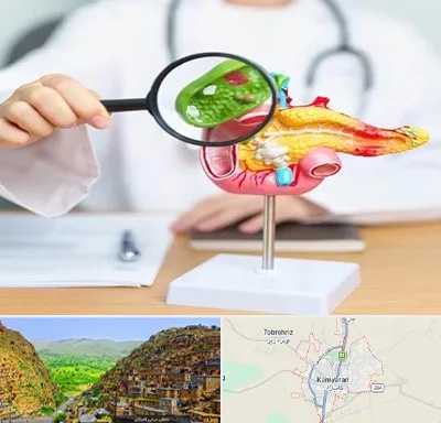 جراح سرطان پانکراس در کامیاران