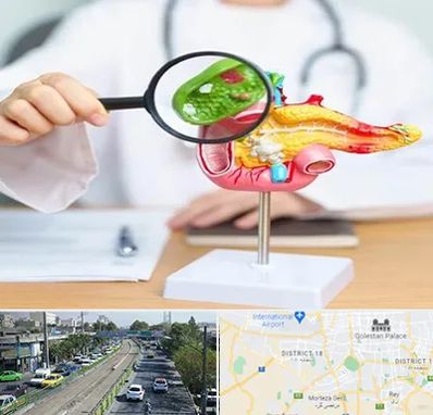 جراح سرطان پانکراس در جنوب تهران 