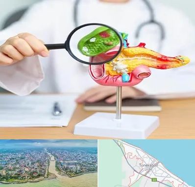 جراح سرطان پانکراس در تنکابن