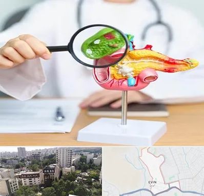 جراح سرطان پانکراس در اوین