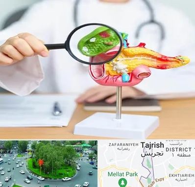 جراح سرطان پانکراس در تجریش 