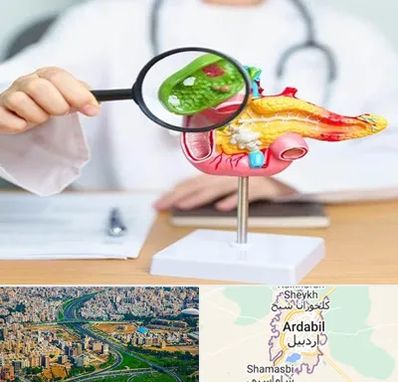 جراح سرطان پانکراس در اردبیل