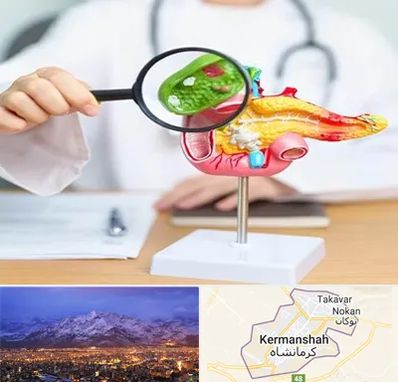 جراح سرطان پانکراس در کرمانشاه