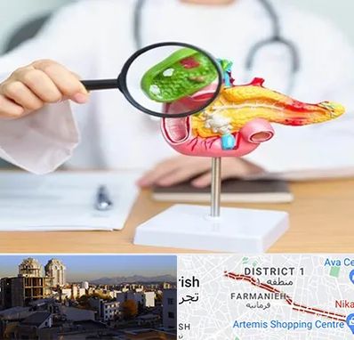 جراح سرطان پانکراس در فرمانیه 