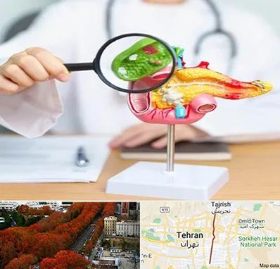 جراح سرطان پانکراس در ولیعصر 
