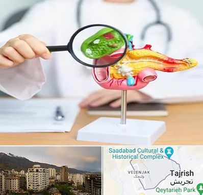 جراح سرطان پانکراس در زعفرانیه