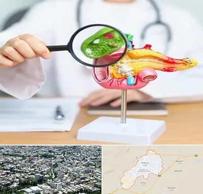 جراح سرطان پانکراس در شاهرود