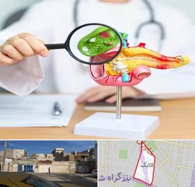 جراح سرطان پانکراس در اتابک
