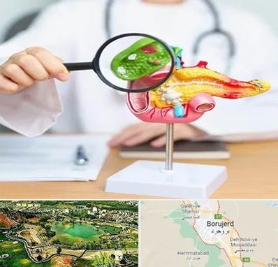 جراح سرطان پانکراس در بروجرد