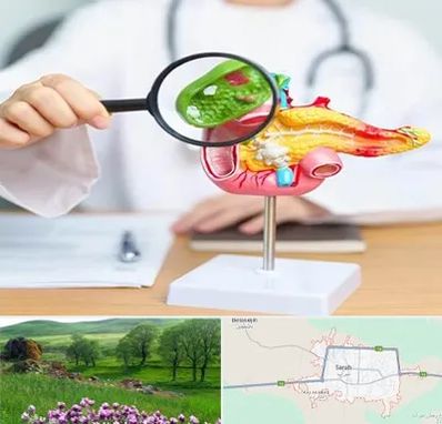 جراح سرطان پانکراس در سراب