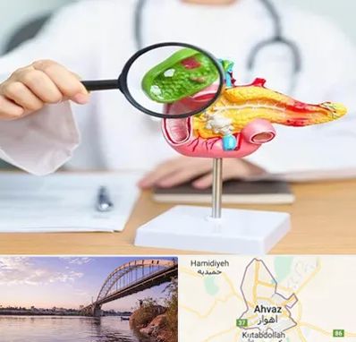 جراح سرطان پانکراس در اهواز