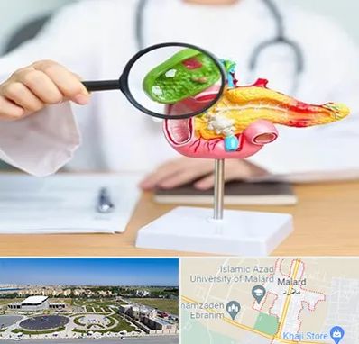 جراح سرطان پانکراس در ملارد