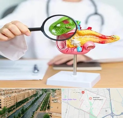 جراح سرطان پانکراس در فاز سه اندیشه