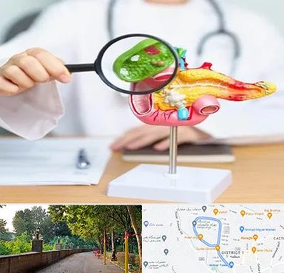 جراح سرطان پانکراس در فلکه گاز رشت 