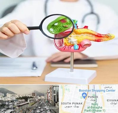 جراح سرطان پانکراس در پونک