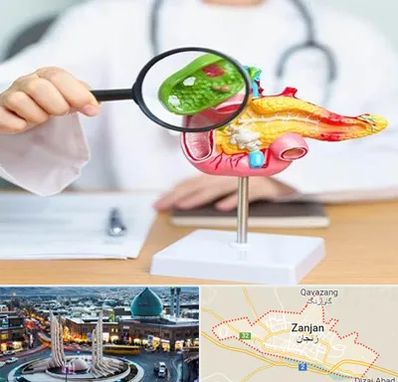 جراح سرطان پانکراس در زنجان