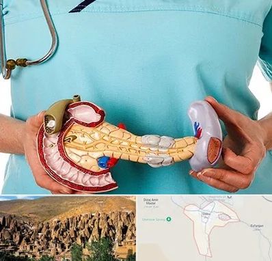 جراح سرطان لوزالمعده در اسکو