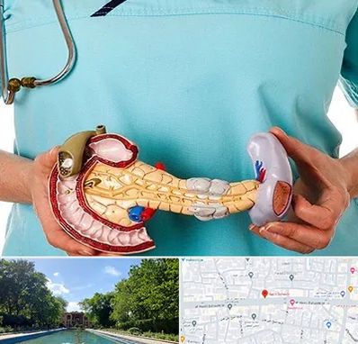 جراح سرطان لوزالمعده در هشت بهشت اصفهان 