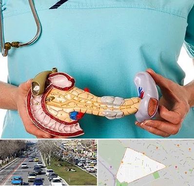 جراح سرطان لوزالمعده در احمدآباد مشهد 