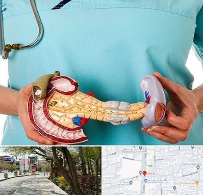 جراح سرطان لوزالمعده در خیابان توحید اصفهان 