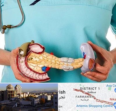 جراح سرطان لوزالمعده در فرمانیه 