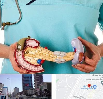 جراح سرطان لوزالمعده در چهارراه طالقانی کرج 