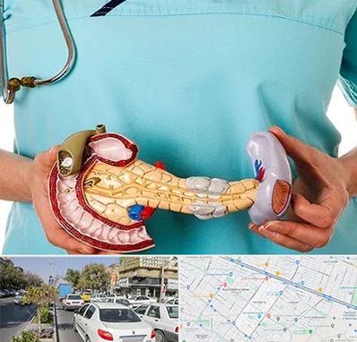 جراح سرطان لوزالمعده در مفتح مشهد 