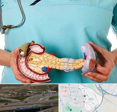 جراح سرطان لوزالمعده در یاغچیان تبریز