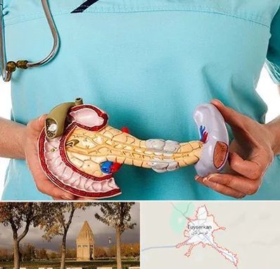 جراح سرطان لوزالمعده در تویسرکان