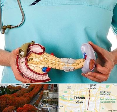 جراح سرطان لوزالمعده در ولیعصر 