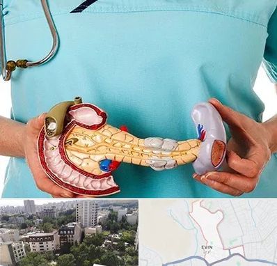 جراح سرطان لوزالمعده در اوین