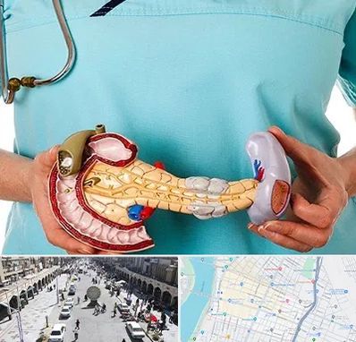 جراح سرطان لوزالمعده در نادری اهواز 