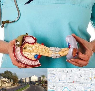 جراح سرطان لوزالمعده در ضیابری رشت 