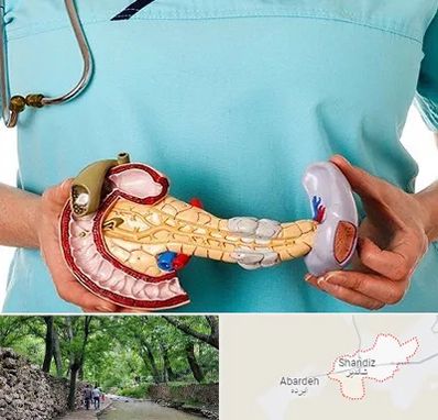 جراح سرطان لوزالمعده در شاندیز مشهد