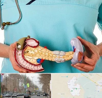 جراح سرطان لوزالمعده در نظرآباد کرج 