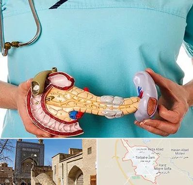 جراح سرطان لوزالمعده در تربت جام