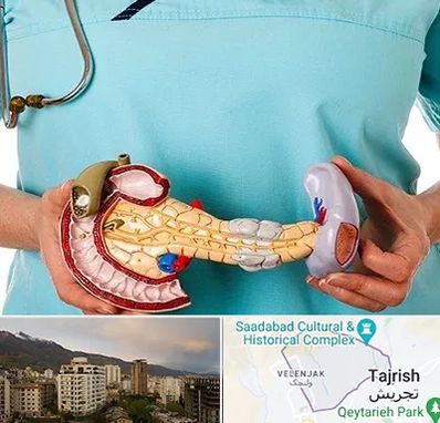 جراح سرطان لوزالمعده در زعفرانیه