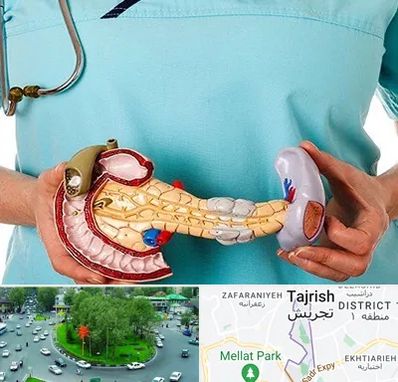 جراح سرطان لوزالمعده در تجریش 