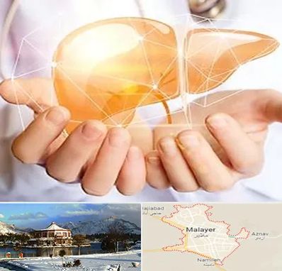 دکتر سرطان کبد در ملایر