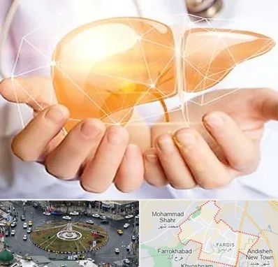 دکتر سرطان کبد در فردیس کرج 