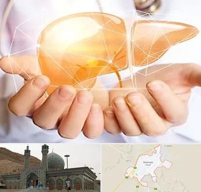 دکتر سرطان کبد در شهرضا