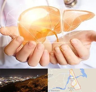 دکتر سرطان کبد در میناب