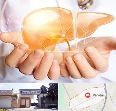 دکتر سرطان کبد در وحیدیه شهریار