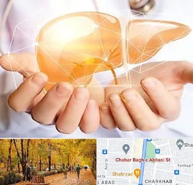 دکتر سرطان کبد در چهارباغ اصفهان 