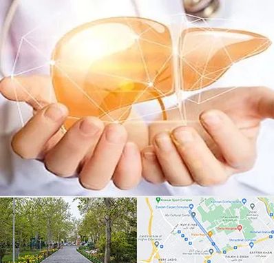 دکتر سرطان کبد در قدوسی غربی شیراز 