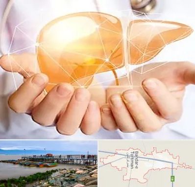 دکتر سرطان کبد در بندر ترکمن