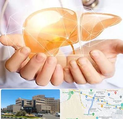 دکتر سرطان کبد در صیاد شیرازی مشهد 